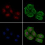 Phospho-ATF1 (Ser198) Antibody in Immunocytochemistry (ICC/IF)