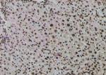 Phospho-ATF1 (Ser198) Antibody in Immunohistochemistry (Paraffin) (IHC (P))