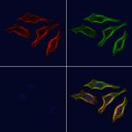 Phospho-PLCG1 (Tyr472) Polyclonal Antibody