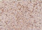 Phospho-PLCG1 (Tyr472) Antibody in Immunohistochemistry (Paraffin) (IHC (P))