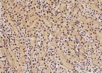Phospho-eIF2 beta (Tyr298) Polyclonal Antibody
