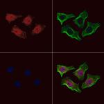 Phospho-MAK (Thr157) Polyclonal Antibody