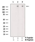 Phospho-Filamin A (Tyr1604) Antibody in Western Blot (WB)