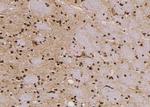 Phospho-ErbB3 (Ser686) Antibody in Immunohistochemistry (Paraffin) (IHC (P))
