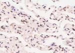 Phospho-ErbB3 (Tyr1197) Antibody in Immunohistochemistry (Paraffin) (IHC (P))