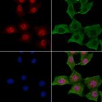 Phospho-Dnmt1 (Ser84) Polyclonal Antibody