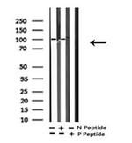 Phospho-EphA2 (Tyr772) Antibody in Western Blot (WB)