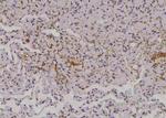 Phospho-EphA2 (Thr587) Polyclonal Antibody