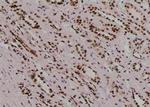 Phospho-TYK2 (Tyr433) Polyclonal Antibody