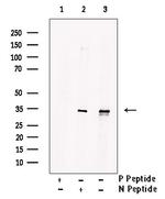 Phospho-MARCKS (Ser27) Polyclonal Antibody