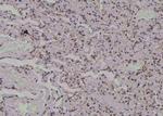 Phospho-MARCKS (Ser170) Polyclonal Antibody