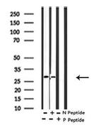 Phospho-MARCKS (Ser170) Antibody in Western Blot (WB)