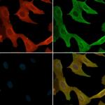 Phospho-Axl (Tyr703) Polyclonal Antibody