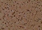 Phospho-Axl (Tyr703) Antibody in Immunohistochemistry (Paraffin) (IHC (P))