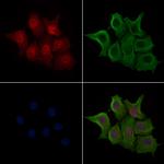 Phospho-NF2 (Ser13) Polyclonal Antibody