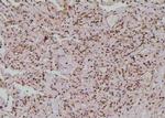 Phospho-NF2 (Ser13) Antibody in Immunohistochemistry (Paraffin) (IHC (P))