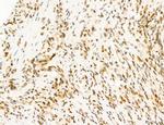 Phospho-FLT3 (Tyr631) Polyclonal Antibody