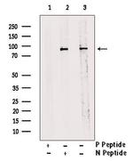 Phospho-STAT3 (Tyr539) Antibody in Western Blot (WB)