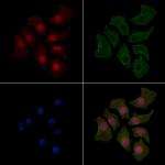 Phospho-STAT3 (Tyr539) Polyclonal Antibody