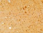 Phospho-mTOR (Ser2454) Antibody in Immunohistochemistry (Paraffin) (IHC (P))
