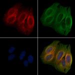 Phospho-CrkL (Tyr198) Polyclonal Antibody