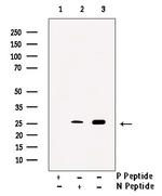 Phospho-Cardiac Troponin I (Ser 23, Ser24) Polyclonal Antibody