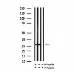 Phospho-Cardiac Troponin I (Ser 23, Ser24) Antibody in Western Blot (WB)