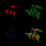 Phospho-MAPKAPK2 (Thr334) Polyclonal Antibody