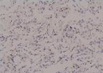 Phospho-MAPKAPK2 (Thr334) Antibody in Immunohistochemistry (Paraffin) (IHC (P))