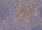 Phospho-MAPKAPK2 (Thr334) Antibody in Immunohistochemistry (Paraffin) (IHC (P))