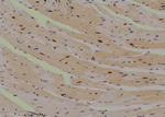 Phospho-MAPKAPK2 (Thr221, Thr222) Polyclonal Antibody