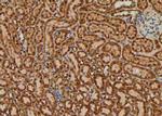 Phospho-RSK2 (Ser369) Antibody in Immunohistochemistry (Paraffin) (IHC (P))