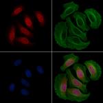 Phospho-RSK2 (Ser369) Polyclonal Antibody