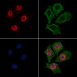 Phospho-RSK2 (Thr577) Polyclonal Antibody