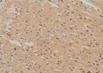 Phospho-p130Cas (Tyr267) Antibody in Immunohistochemistry (Paraffin) (IHC (P))