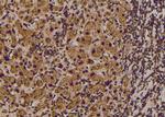 Phospho-RHOA (Thr100) Antibody in Immunohistochemistry (Paraffin) (IHC (P))