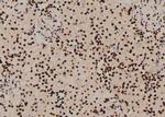 Phospho-S6 (Tyr209) Antibody in Immunohistochemistry (Paraffin) (IHC (P))