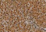 Phospho-YBX1 (Ser176) Antibody in Immunohistochemistry (Paraffin) (IHC (P))
