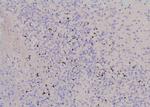 Phospho-YBX1 (Tyr162) Antibody in Immunohistochemistry (Paraffin) (IHC (P))