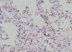 Phospho-YBX1 (Tyr162) Antibody in Immunohistochemistry (Paraffin) (IHC (P))
