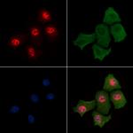 Phospho-Histone H3 (Ser58) Antibody in Immunocytochemistry (ICC/IF)