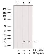 Phospho-Histone H3 (Ser58) Antibody in Western Blot (WB)