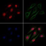 Phospho-Histone H3 (Thr12) Antibody in Immunocytochemistry (ICC/IF)