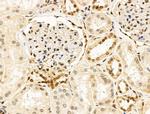 Phospho-Histone H3 (Thr12) Antibody in Immunohistochemistry (Paraffin) (IHC (P))