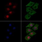 Phospho-Histone H3 (Thr81) Antibody in Immunocytochemistry (ICC/IF)