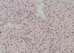 Phospho-Histone H3 (Thr81) Antibody in Immunohistochemistry (Paraffin) (IHC (P))