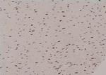 Phospho-Histone H3 (Thr81) Antibody in Immunohistochemistry (Paraffin) (IHC (P))