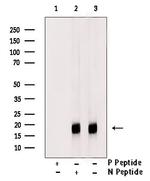 Phospho-Histone H3 (Thr81) Antibody in Western Blot (WB)