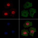 Phospho-MEF2A (Ser479) Polyclonal Antibody