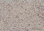Phospho-MEF2A (Ser479) Antibody in Immunohistochemistry (Paraffin) (IHC (P))